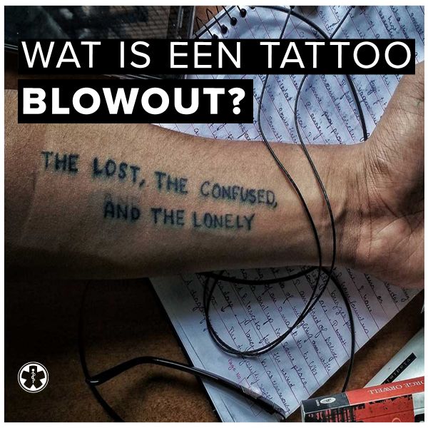 Wat is dat, een tattoo blowout?