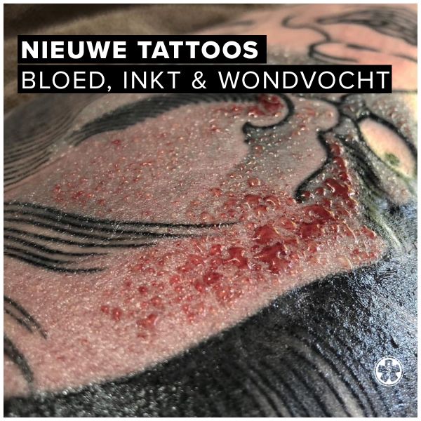 Help! Er komt allemaal bloed, inkt en wondvocht uit mijn nieuwe tattoo!